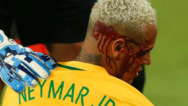 Neymar injury