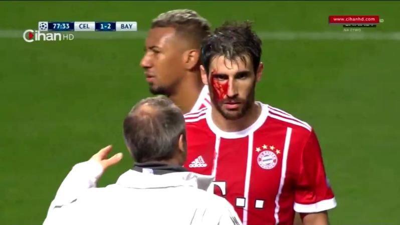 Javi Martinez bleeding