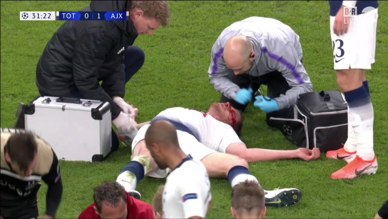 Jan Vertonghen Injury