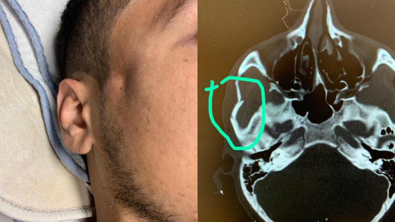 Zlatan Elbow El-Munir