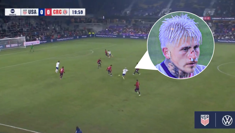 Diego Luna broken nose assist vs Costa Rica