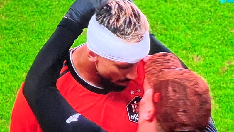 Héctor Herrera sufre corte en la cara vs Minnesota United
