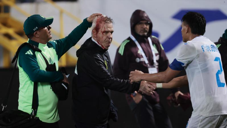 Concacaf Honduras sanction dealt