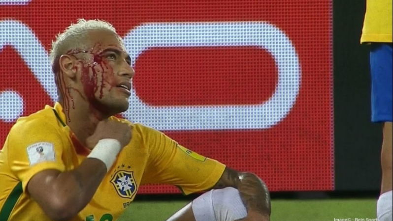 Neymar bloody
