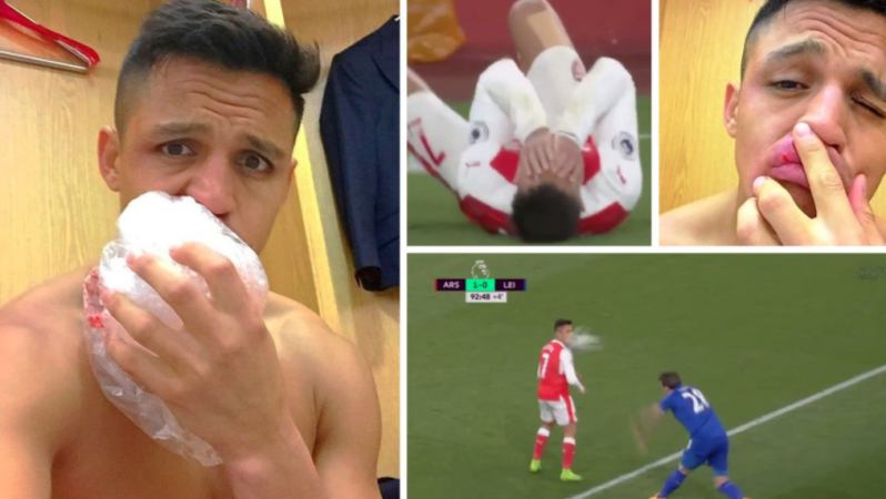 Alexis Sanchez flop vs Leicester 