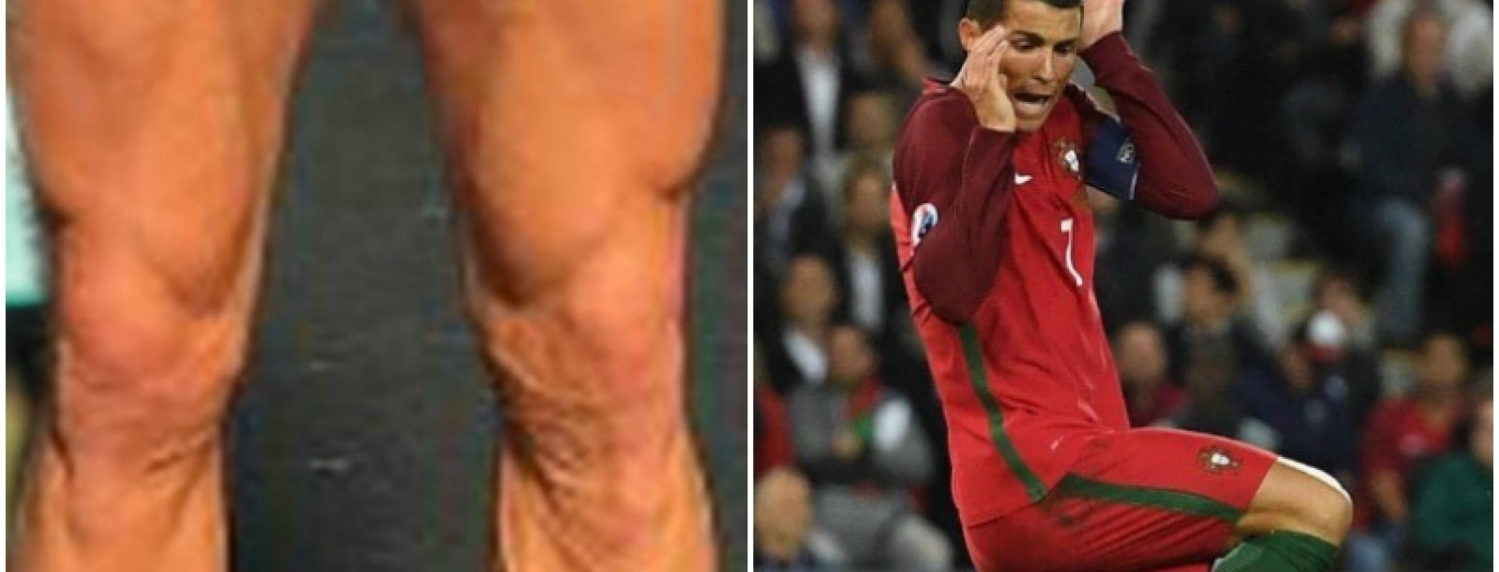 Cristiano Ronaldo Wants You To Check Out His Legs