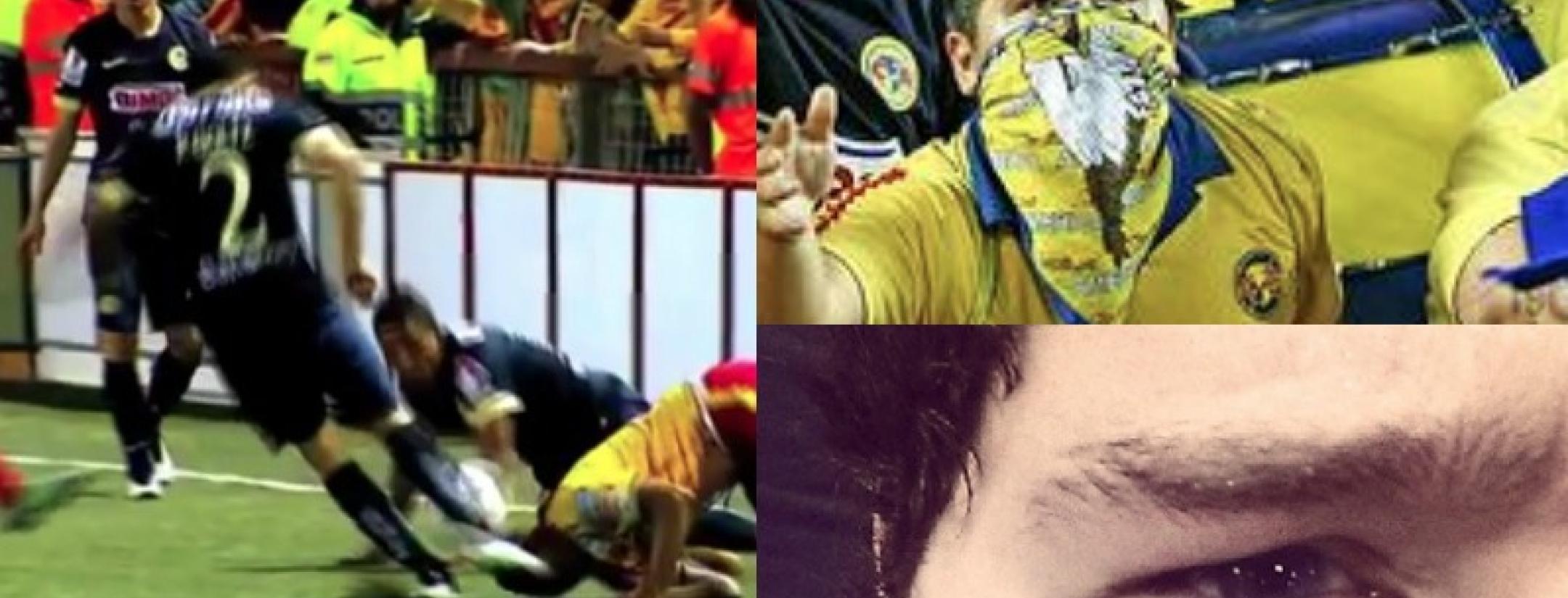  herediano-club-america-arroyo-lagos-goltz-head-kick