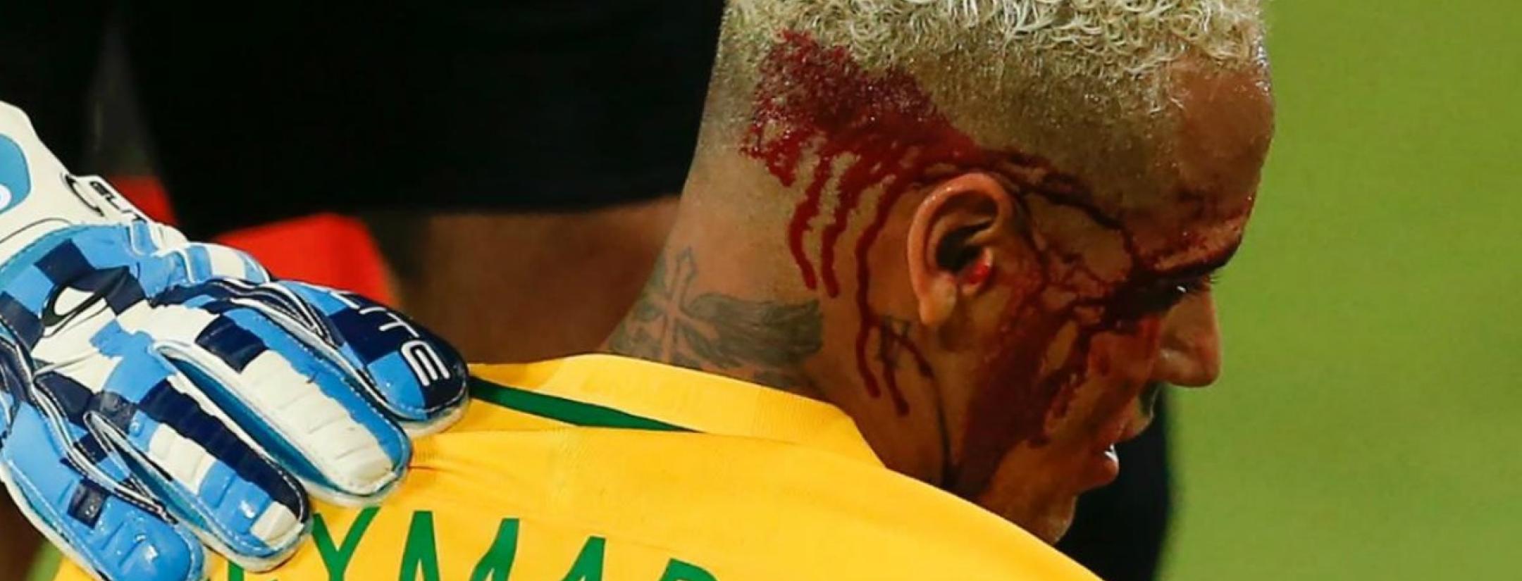 Neymar injury