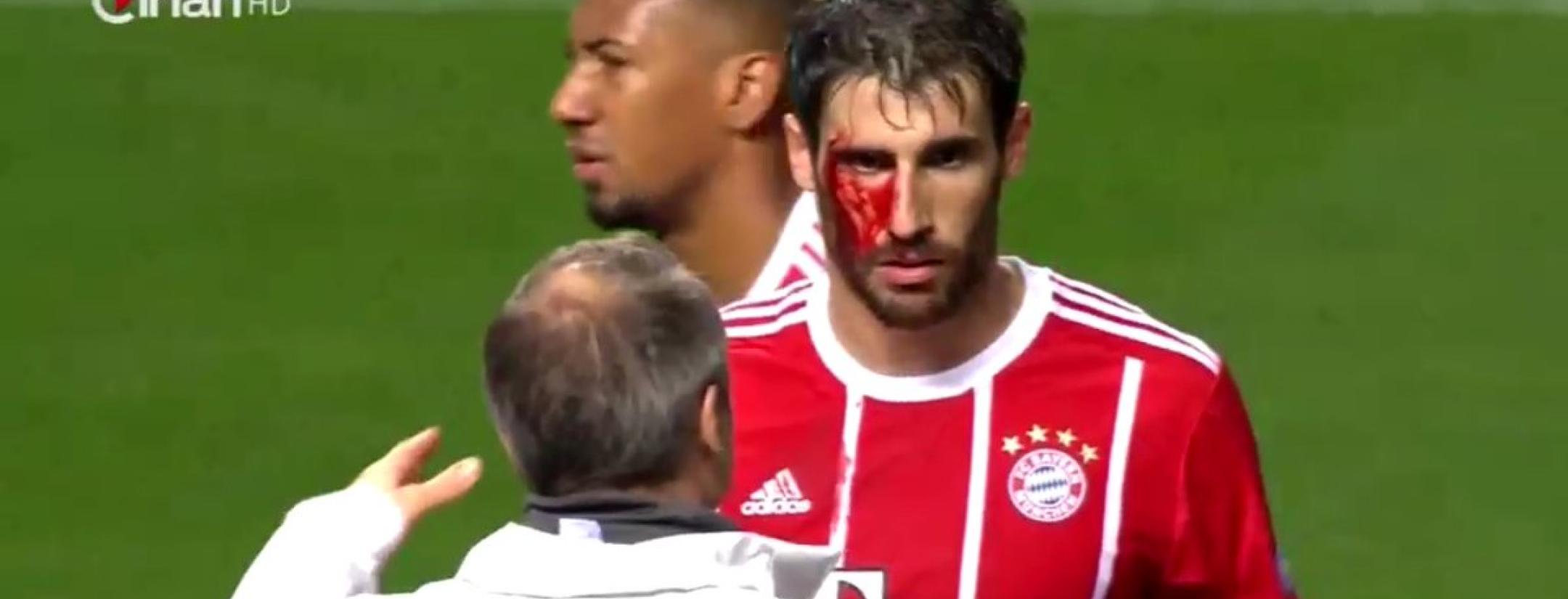 Javi Martinez bleeding