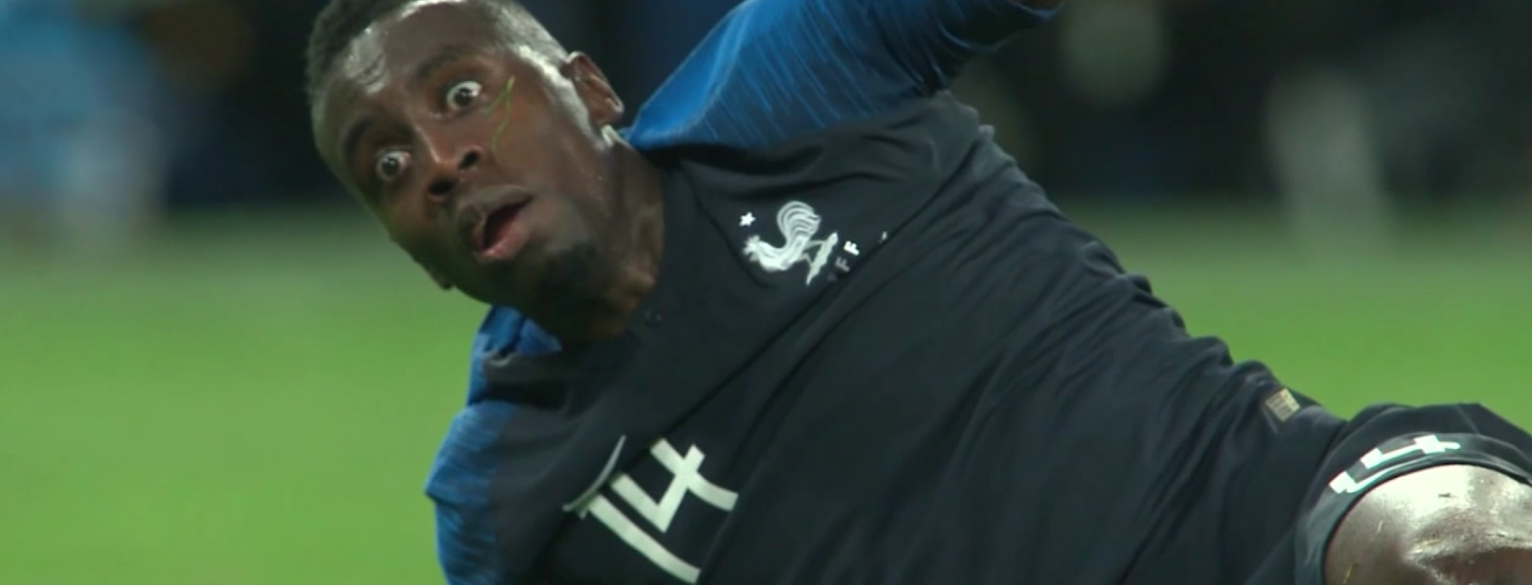 On field treatment following the Matuidi concussion shows soccer still has a ways to go.