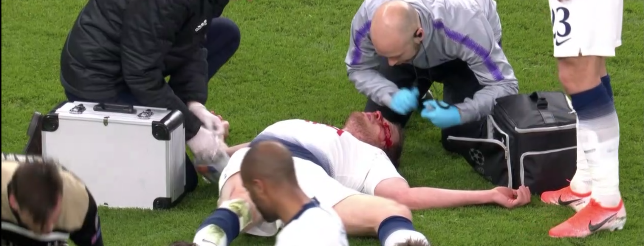 Jan Vertonghen Injury