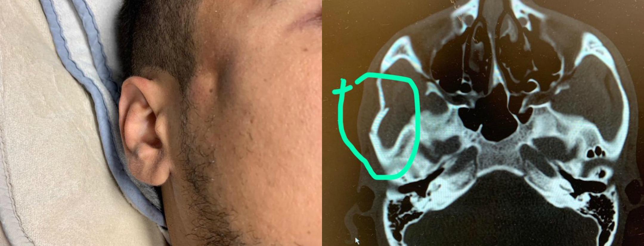 Zlatan Elbow El-Munir