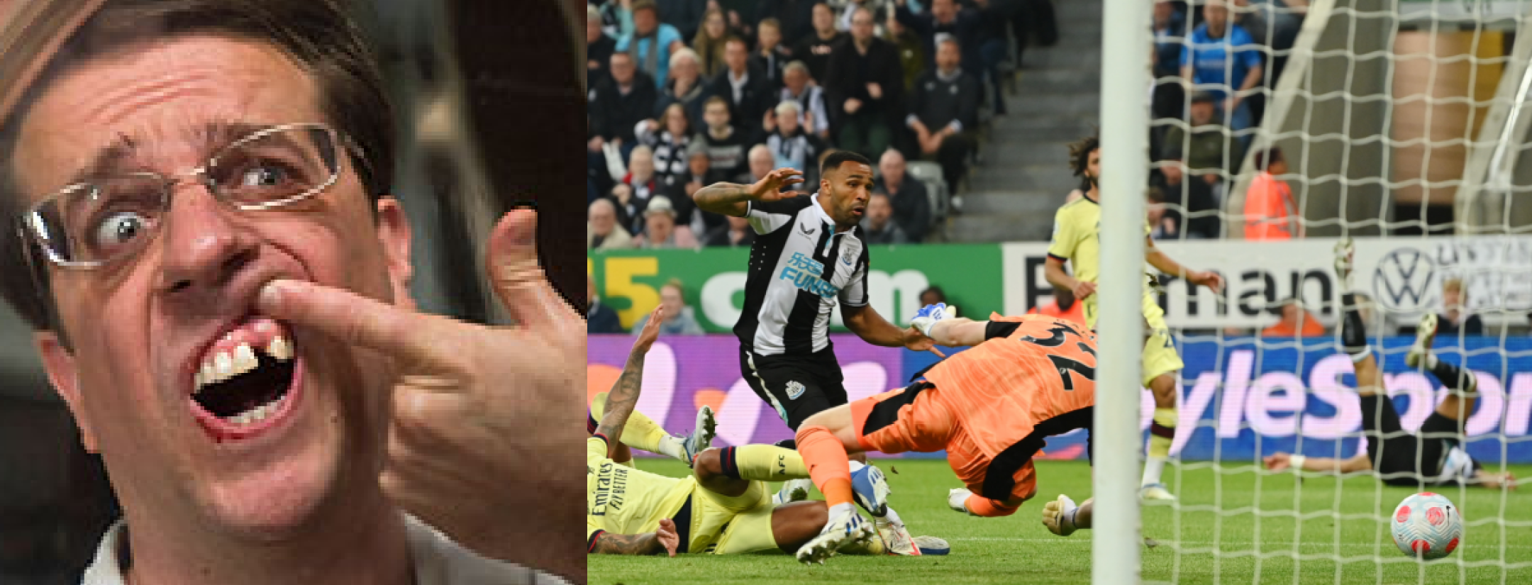 Callum Wilson’s Tooth