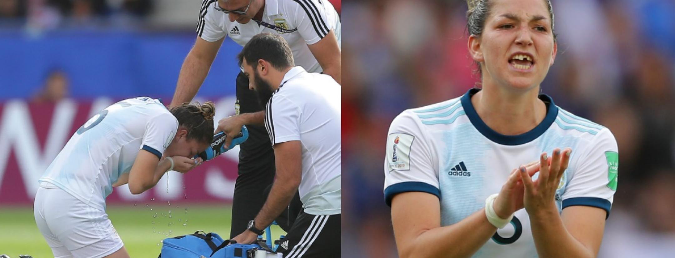 Aldana Cometti chipped tooth