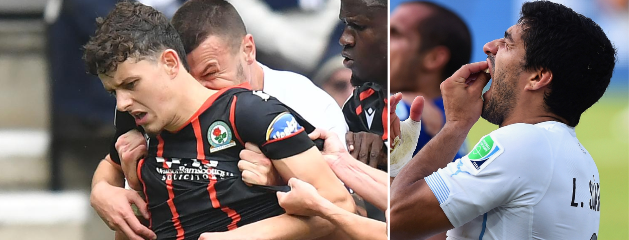 Player banned for biting