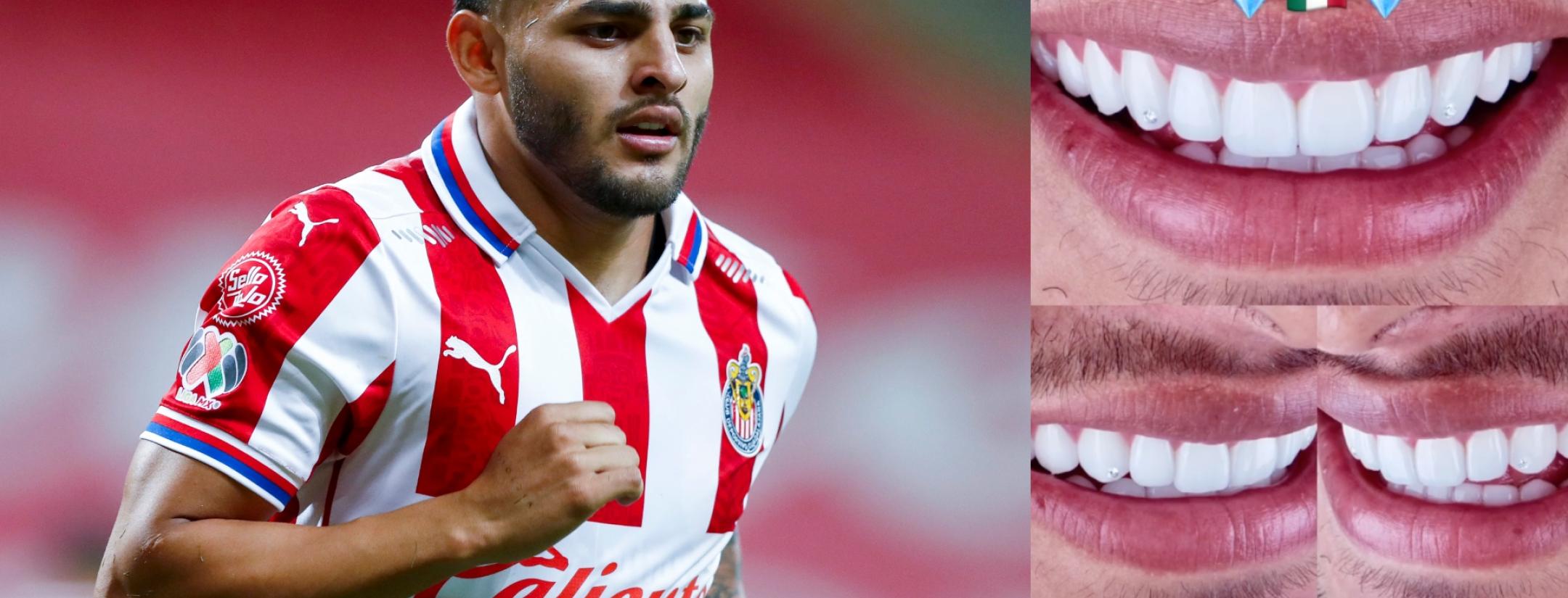 Alexis Vega Se Incrusta Diamantes