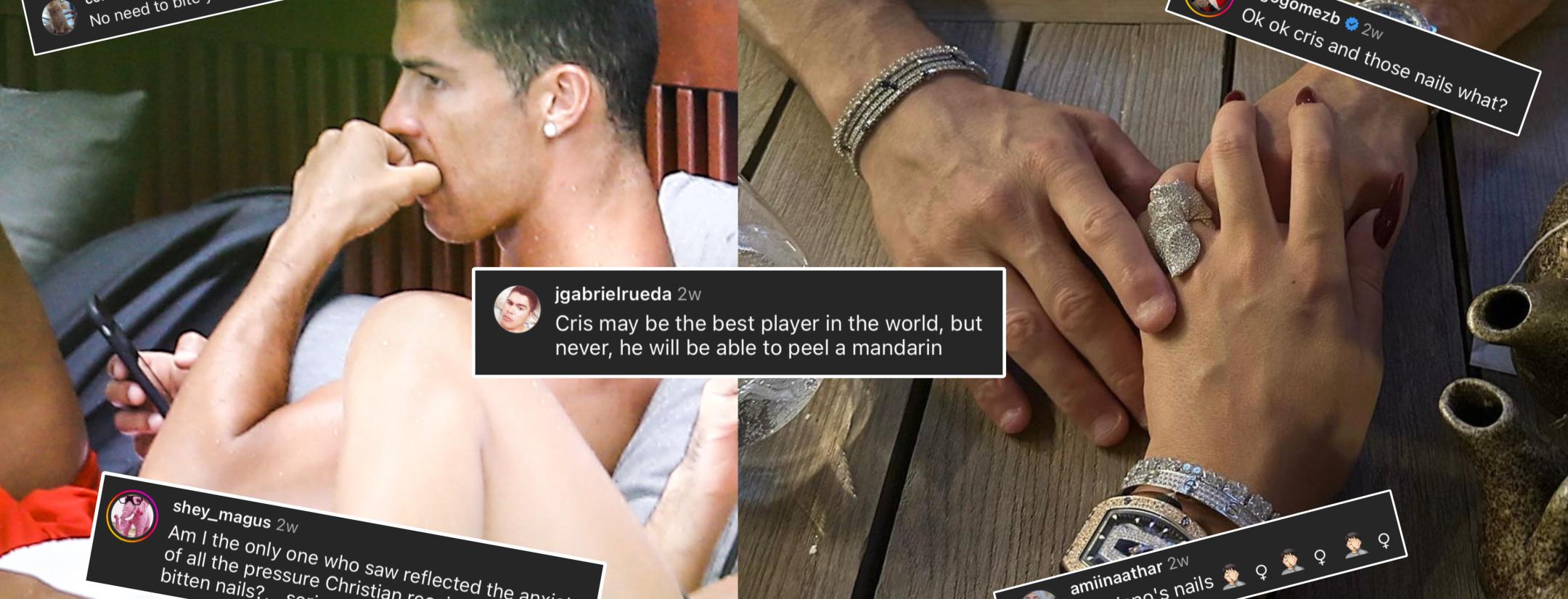 Cristiano Ronaldo biting his finger nails