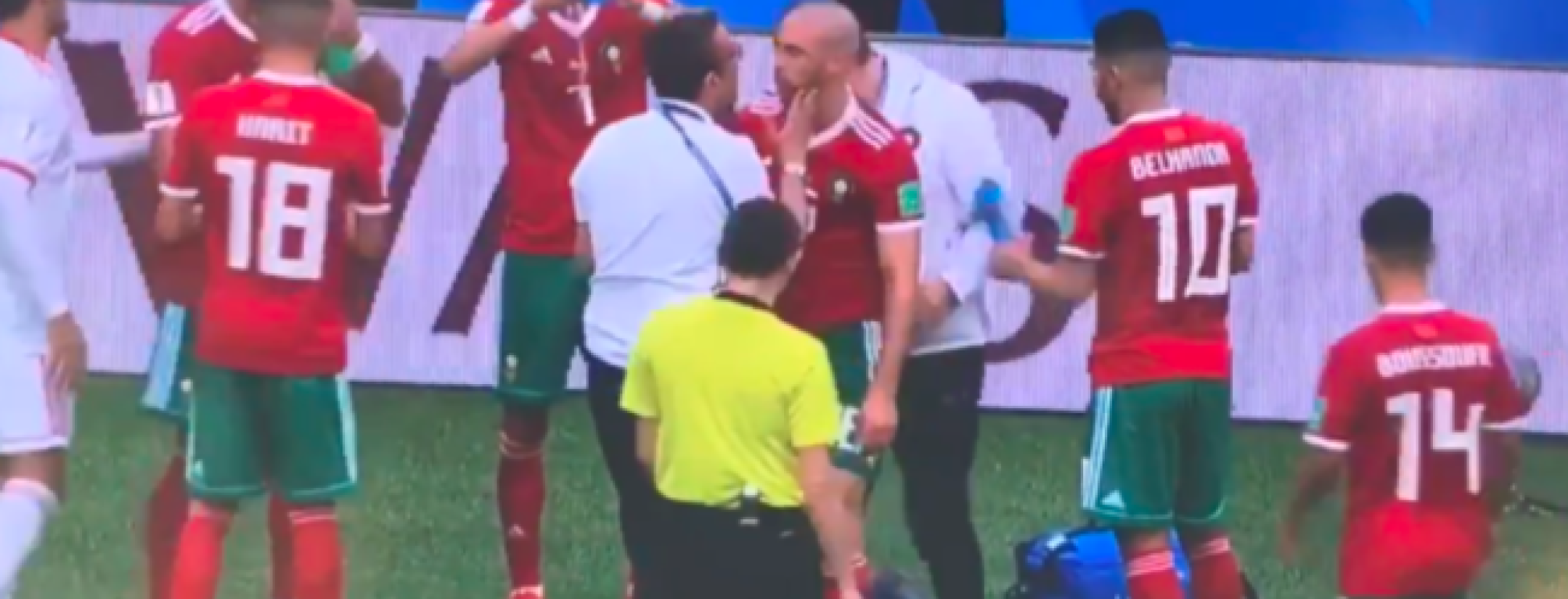 Morocco Concussion