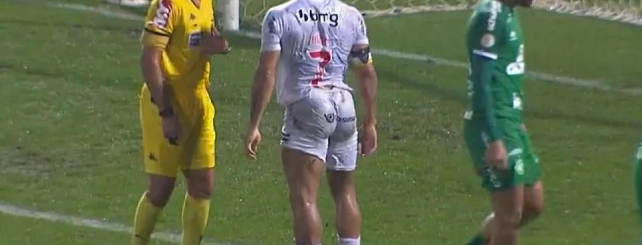 Hulk Butt Image Goes Viral