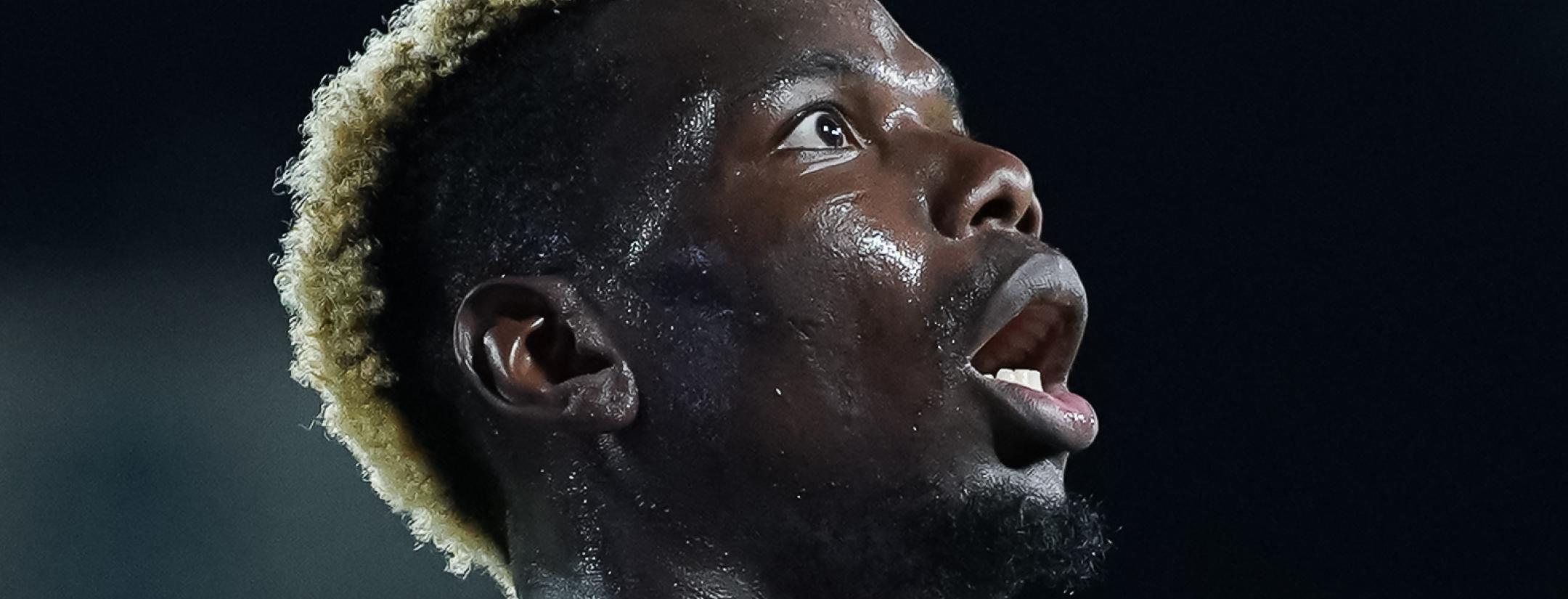 Pogba steroids accusation