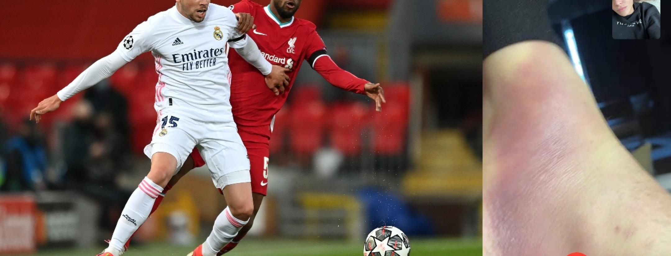 Tobillo Valverde Liverpool vs Real Madrid