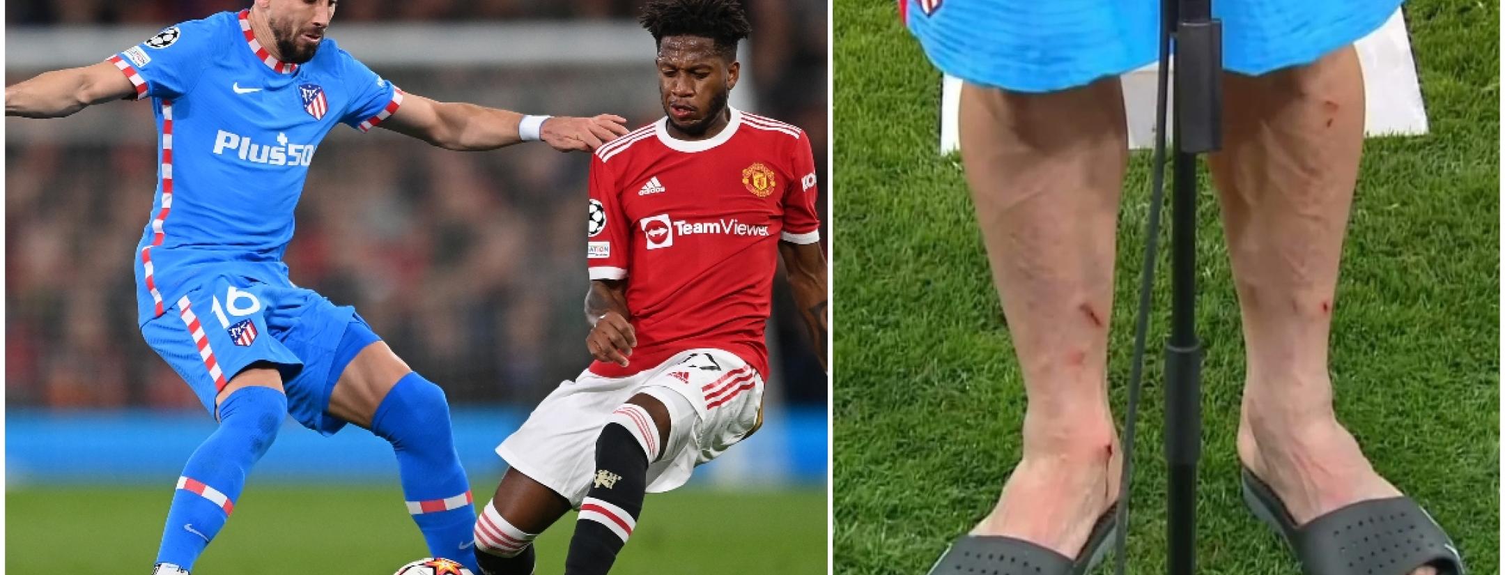 Piernas de Héctor Herrera