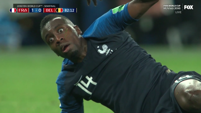 On field treatment following the Matuidi concussion shows soccer still has a ways to go.
