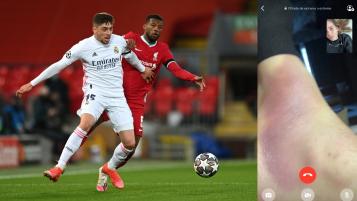 Tobillo Valverde Liverpool vs Real Madrid Tobillo Valverde Liverpool vs Real Madrid