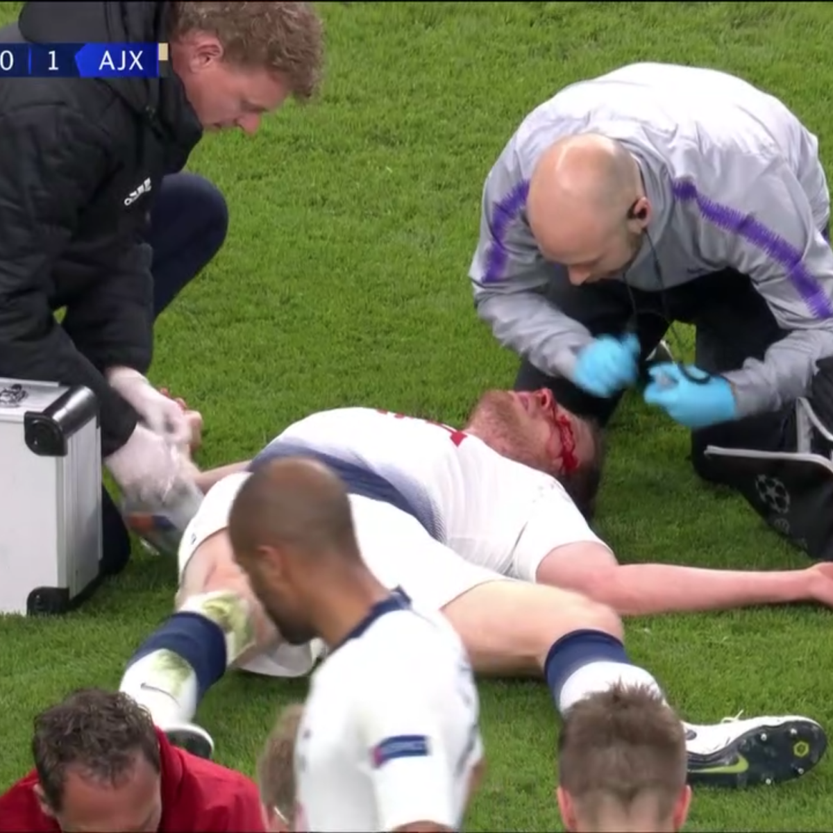Jan Vertonghen Injury