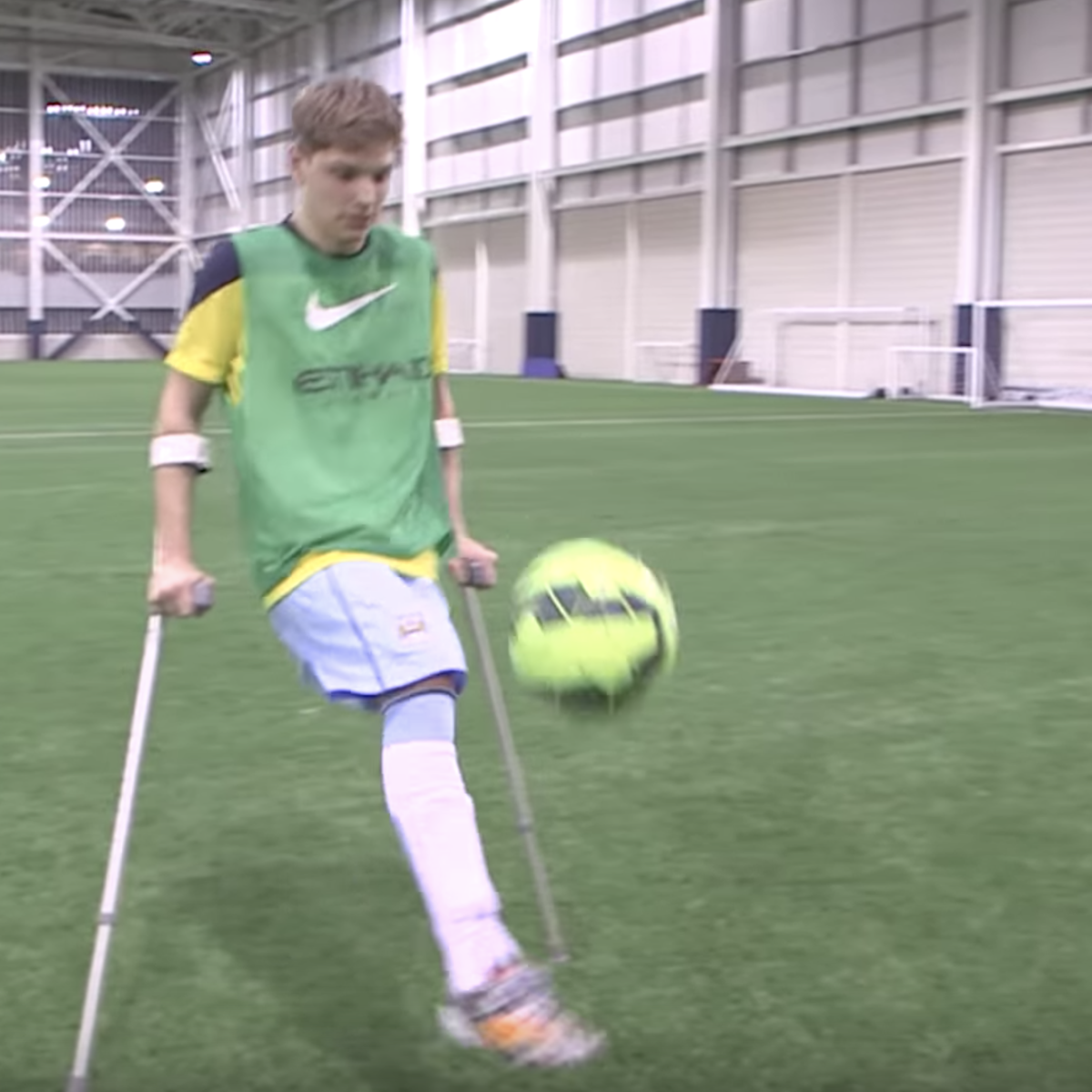 Jamie Tregaskiss Manchester City Amputee Footballer
